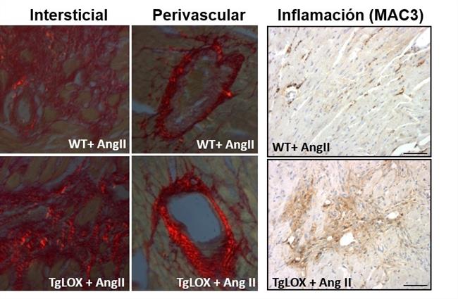 Lisil Oxidasa (Tglox) | CIBERCV ep lisil oxidasa tglox