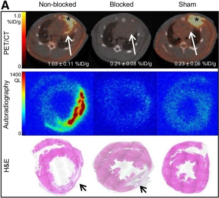 ep prueba de especificidad de enlace z varasteh y s robu departamento de medicina nuclear klinikum
