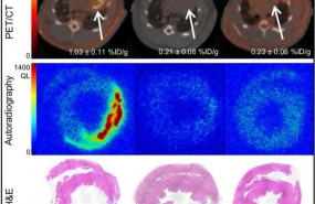 ep prueba de especificidad de enlace z varasteh y s robu departamento de medicina nuclear klinikum