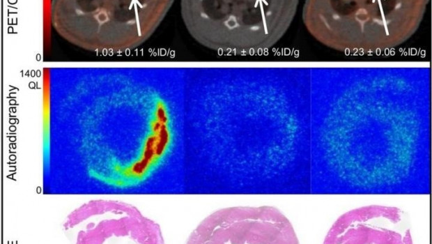ep prueba de especificidad de enlace z varasteh y s robu departamento de medicina nuclear klinikum
