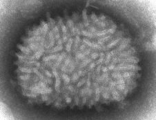 ep imagen al microscopio del virus vaccinia