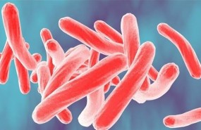 ep nueva cepa multirresistentetuberculosis