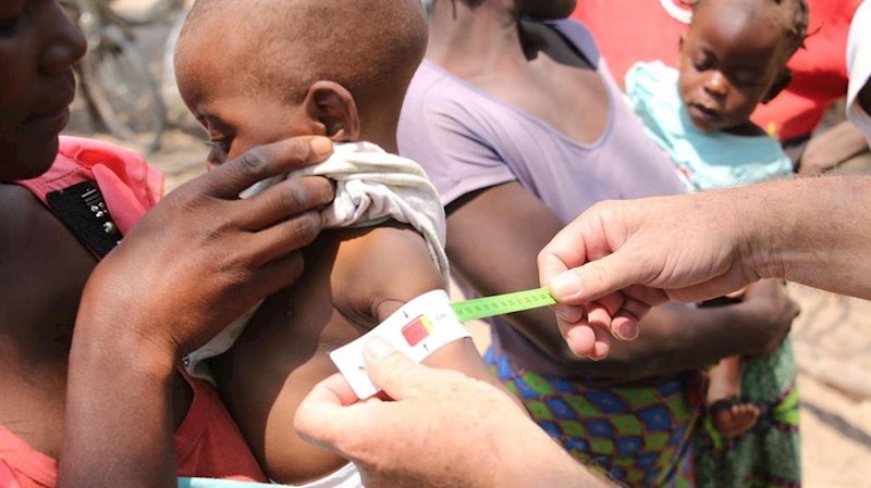 ep a un nino le miden el contorno del brazo en el sur de africa