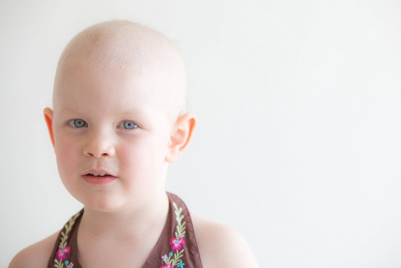 ep imagen de recurso de una nina con cancer cancer infantil