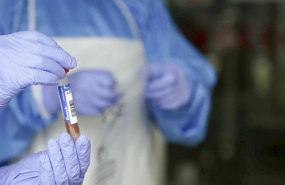 ep un sanitario protegido con guantes sostiene un muestra para realizar un analisis pcr