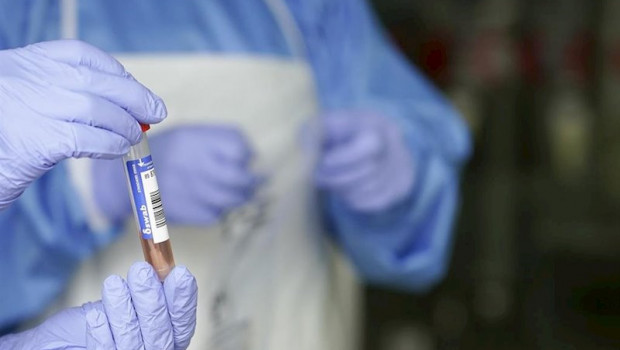 ep un sanitario protegido con guantes sostiene un muestra para realizar un analisis pcr