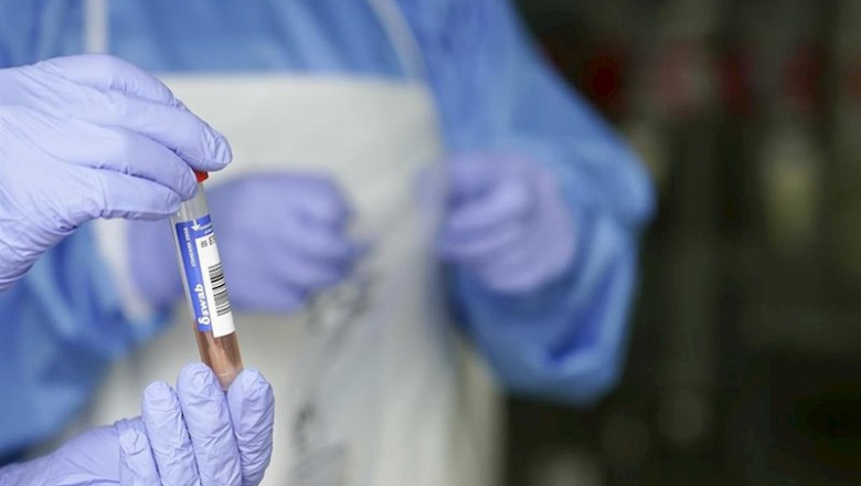 ep un sanitario protegido con guantes sostiene un muestra para realizar un analisis pcr ep un sanitario protegido con guantes sostiene un muestra para realizar un analisis pcr