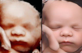 antes despues 1 20221213135826 