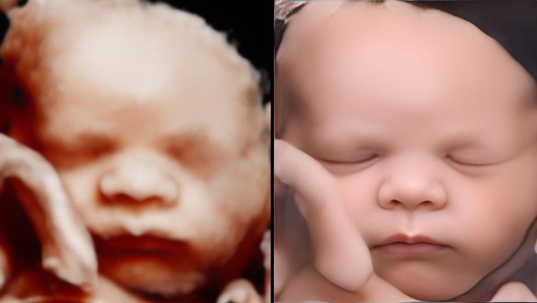 antes despues 1 20221213135826 