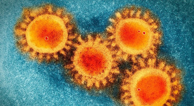 ep foto de microscopio electronico del coronavirus sars-cov-2 que causa la covid-19 ep foto de microscopio electronico del coronavirus sars-cov-2 que causa la covid-19