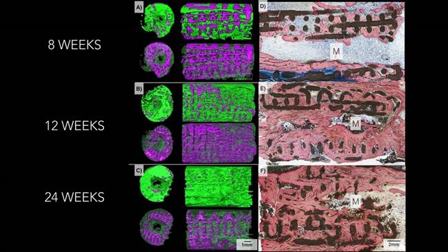 Implante de cerámica | JOURNAL OF TISSUE ENGINEERING AND REGENERATIVE MED ep implanteceramica