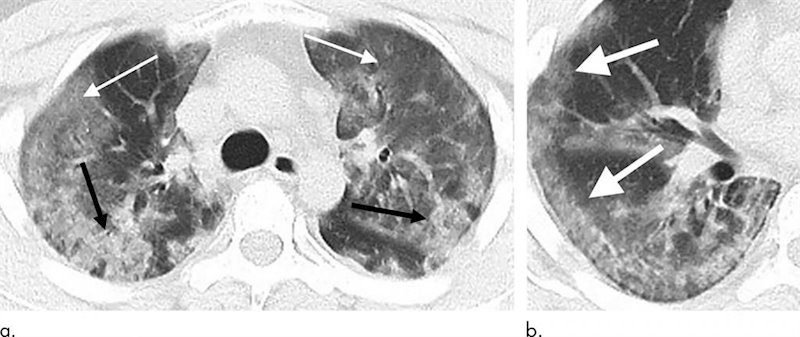 Cma Urges Retailers To Act Responsibly During Coronavirus Outbreak Sharecast Com