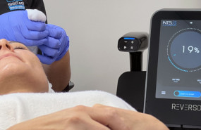 reverso application images img 0189 