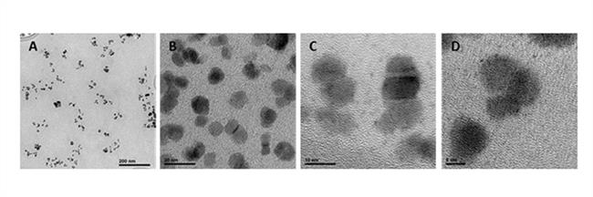 Nanopartículas de óxido de hierro son portadoras de antitumorales | EL CENTRO DEL CÁNCER ep nanoparticulas de oxidohierro portadorasantitumorales