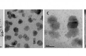 ep nanoparticulas de oxidohierro portadorasantitumorales