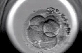 ep embrion fertilizado reproduccion in vitro