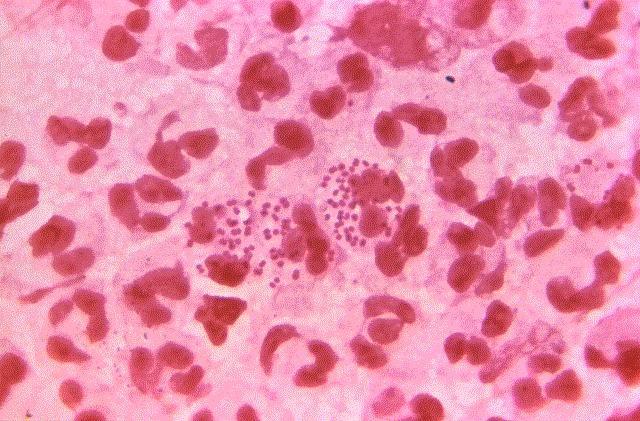 Neisseria gonorrhoeae, gonorrea | CDC/ BILL SCHWARTZ - Archivo ep neisseria gonorrhoeae gonorrea