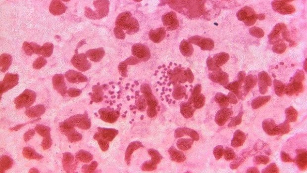 ep neisseria gonorrhoeae gonorrea