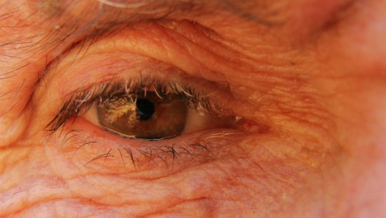 Ojo anciano, degeneración macular, hombre mayor | FLICKR / ORLANDO SØRENSEN - Archivo ep ojo anciano degeneracion macular hombre mayor 20190806130203