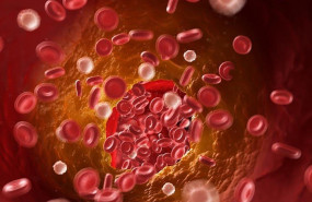 ep sangre trombosis 20200519183102