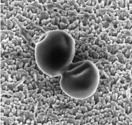 ep imagenesmicroscopia electronicabarridodos staphylococcus aureus sobr