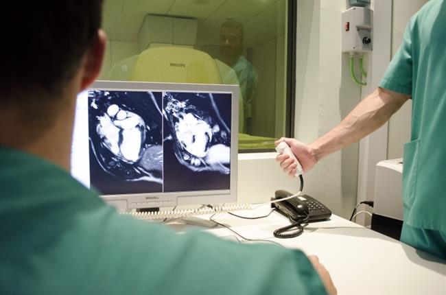 ep intervencionun corazon infartado