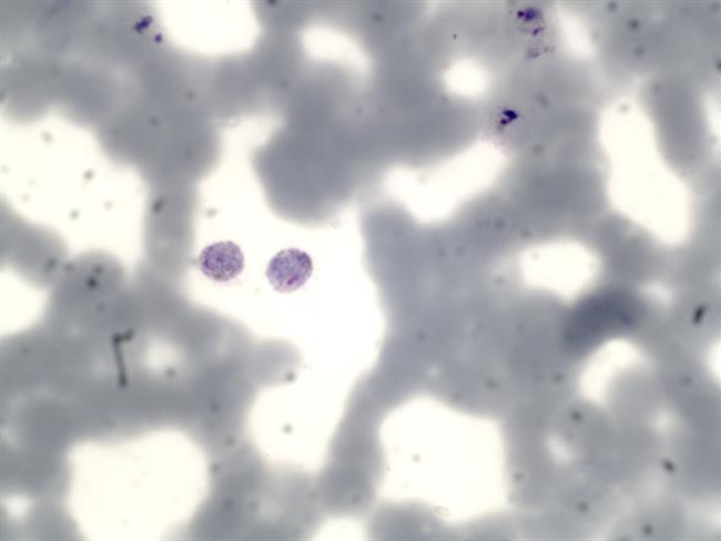 Plasmodium Vivax | FLICKRVIVIEN ROLFE ep plasmodium vivax