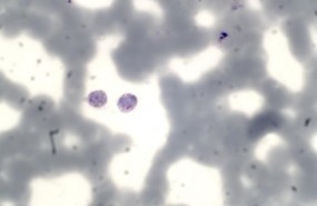 ep plasmodium vivax
