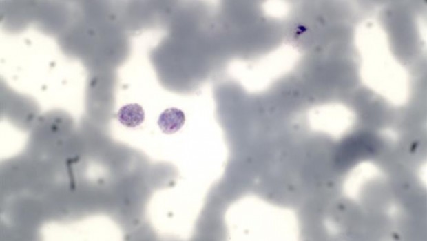 ep plasmodium vivax