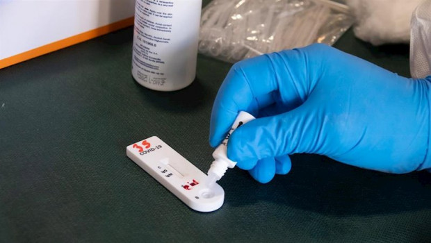 ep test de coronavirus 20200510151003