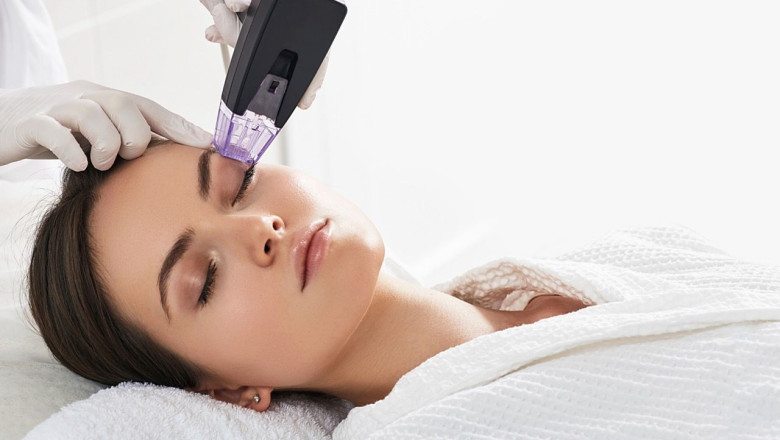 radiofrecuencia facial en tamano grande