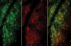 ep neuronas excitadoras verdes e inhibidoras rojas mostradas en esta imagen microscopica del cerebro