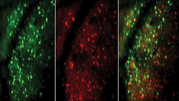 ep neuronas excitadoras verdes e inhibidoras rojas mostradas en esta imagen microscopica del cerebro