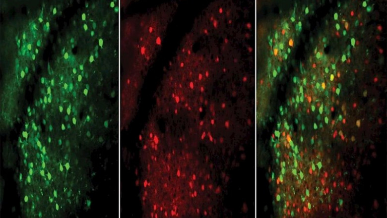 Neuronas excitadoras (verdes) e inhibidoras (rojas), mostradas en esta imagen microscópica del cerebro de un ratón, responden más rápida e inmediatamente a medida que el animal mejora en la realización de una tarea. | CHURCHLAND LAB/CSHL, 2019 ep neuronas excitadoras verdes e inhibidoras rojas mostradas en esta imagen microscopica del cerebro