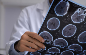 alzheimer aei 20230921145209 alzheimer aei 20230921145209