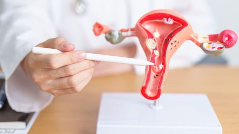 endometriosis en tamano grande