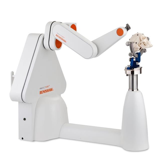Más 80% pacientes epilepsia mejoría sometidos a cirugía robótica | QUIRÓNSALUD ep mas 80 pacientes epilepsia mejoria sometidoscirugia robotica