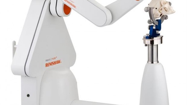 ep mas 80 pacientes epilepsia mejoria sometidoscirugia robotica