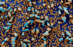 ep micrografia electronica de barrido coloreada de una celula vero e6 en azul infectada con