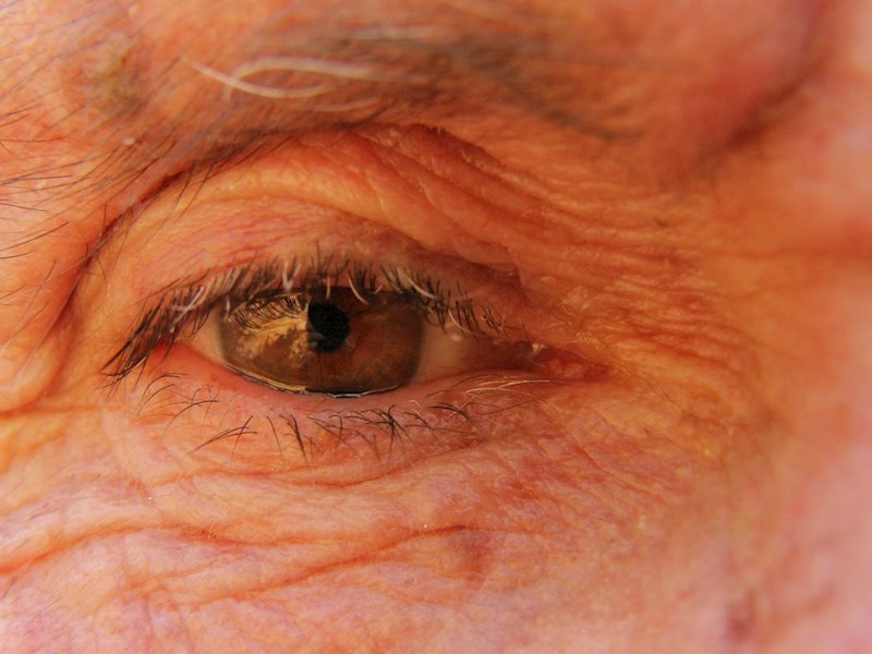 ep ojo anciano degeneracion macular hombre mayor