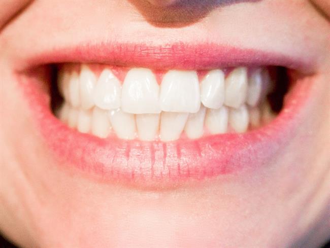 ep dientes bruxismo