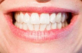 ep dientes bruxismo