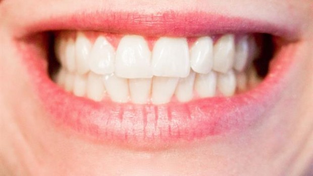 ep dientes bruxismo