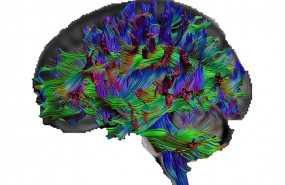 ep con imagentensordifusion los investigadoresvisualizarviaslas fibras nerviosascerebro