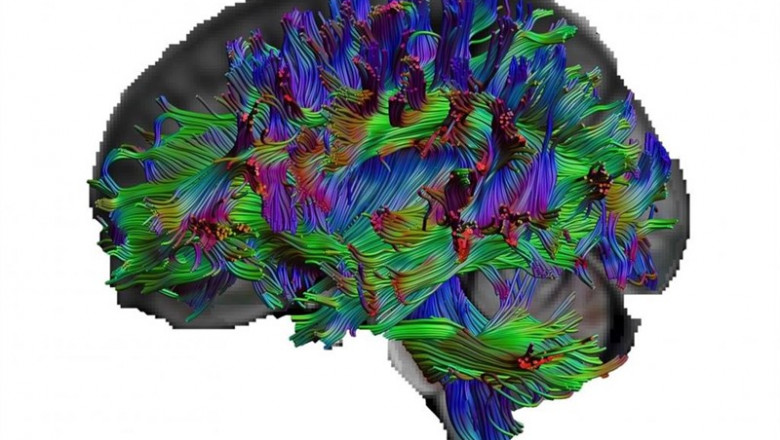 Con imagen del tensor de difusión, los investigadores pueden visualizar las vías de las fibras nerviosas del cerebro | RUB, ERHAN GENÇ ep con imagentensordifusion los investigadoresvisualizarviaslas fibras nerviosascerebro