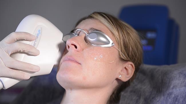 Terapia con Luz Pulsada Ultra regulada Intensa | QUIRONSALUD ep terapialuz pulsada ultra regulada intensa