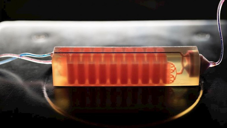Una trampa celular impresa en 3D desarrollada en el laboratorio de Georgia Tech Assistant Professor A. Fatih Sarioglu captura las células sanguíneas para aislar las células tumorales de una muestra de sangre. | ALLISON CARTER, GEORGIA TECH. ep una trampa celular impresa en 3d desarrollada en el laboratorio de georgia tech assistant