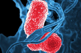 ep los globulos blancos azul atacan a dos bacterias klebsiella rosa en esta imagen microscopica