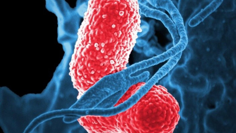 Los glóbulos blancos (azul) atacan a dos bacterias 'Klebsiella' (rosa) en esta imagen microscópica electrónica de barrido coloreada. | DAVID DORWARD/NIAID ep los globulos blancos azul atacan a dos bacterias klebsiella rosa en esta imagen microscopica