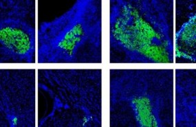 ep nuevo biomaterialreparartejido nervioso danado